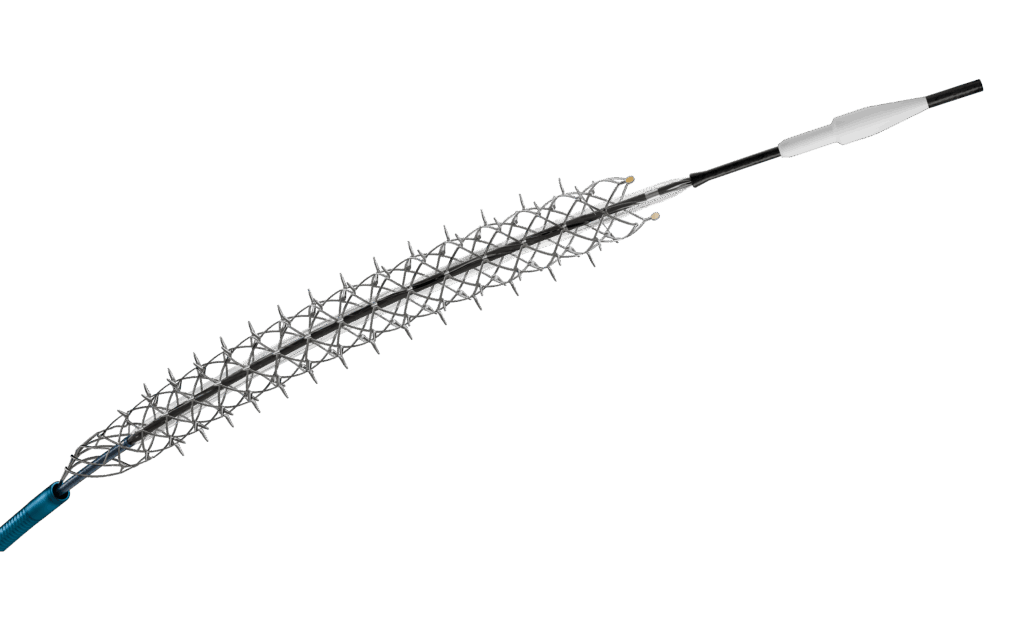 A rendering of Reflow Medical's Spur self-expanding stent