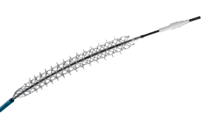 A rendering of Reflow Medical's Spur self-expanding stent
