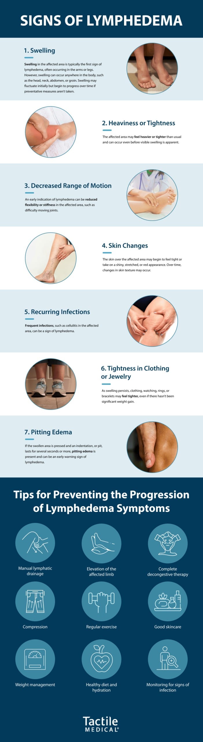 Signs of Lymphedema from Tactile Medical®