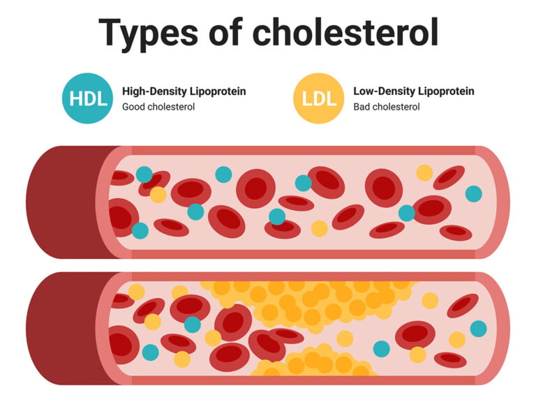 Visual of HDL and LDL in an artery with red blood cells